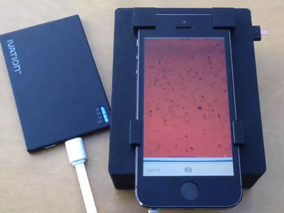 iPhone превратили в детектор паразитов